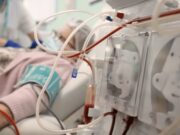 La malaltia renal crònica augmenta el seu impacte a Espanya amb més tractaments renals