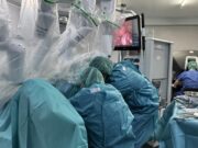 Cirurgia robòtica: clau en el tractament de l’endometriosi profunda i la fertilitat