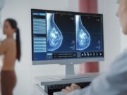 Un procés assistencial integrat aposta per una atenció basada en valor en oncologia